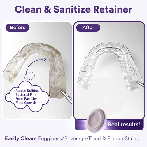 Cleaner tablets for aligners and retainers